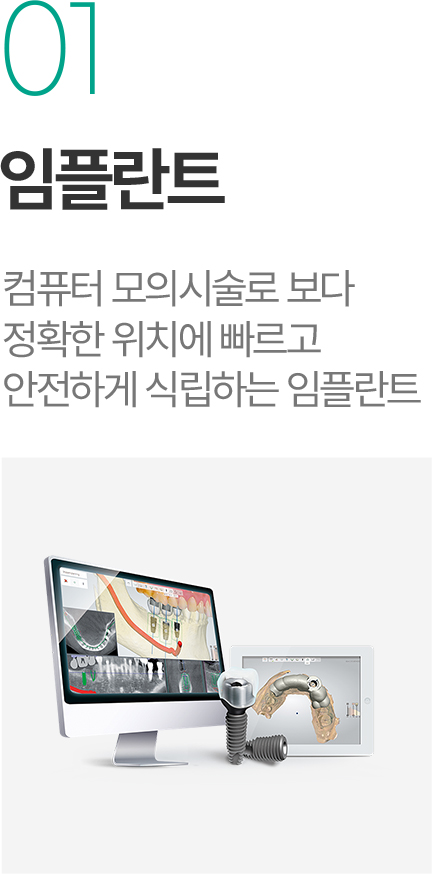 임플란트 - 컴퓨터 모의시술로 정확한 위치에 빠르고 안전하게 식립하는 임플란트 임플란트 - 컴퓨터 모의시술로 정확한 위치에 빠르고 안전하게 식립하는 임플란트