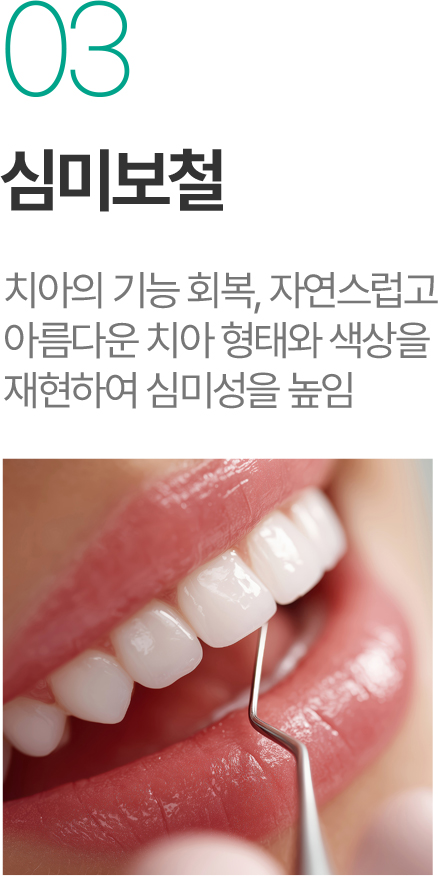 심미보철 - 자연스러운 치아 형태와 색상 재현 심미보철 - 자연스러운 치아 형태와 색상 재현