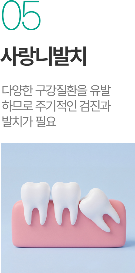 사랑니발치 - 구강질환 예방을 위한 검진과 발치 사랑니발치 - 구강질환 예방을 위한 검진과 발치