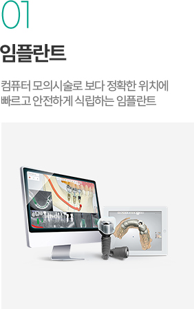 임플란트 - 컴퓨터 모의시술로 정확한 위치에 빠르고 안전하게 식립하는 임플란트 임플란트 - 컴퓨터 모의시술로 정확한 위치에 빠르고 안전하게 식립하는 임플란트
