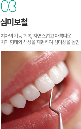 심미보철 - 자연스러운 치아 형태와 색상 재현 심미보철 - 자연스러운 치아 형태와 색상 재현